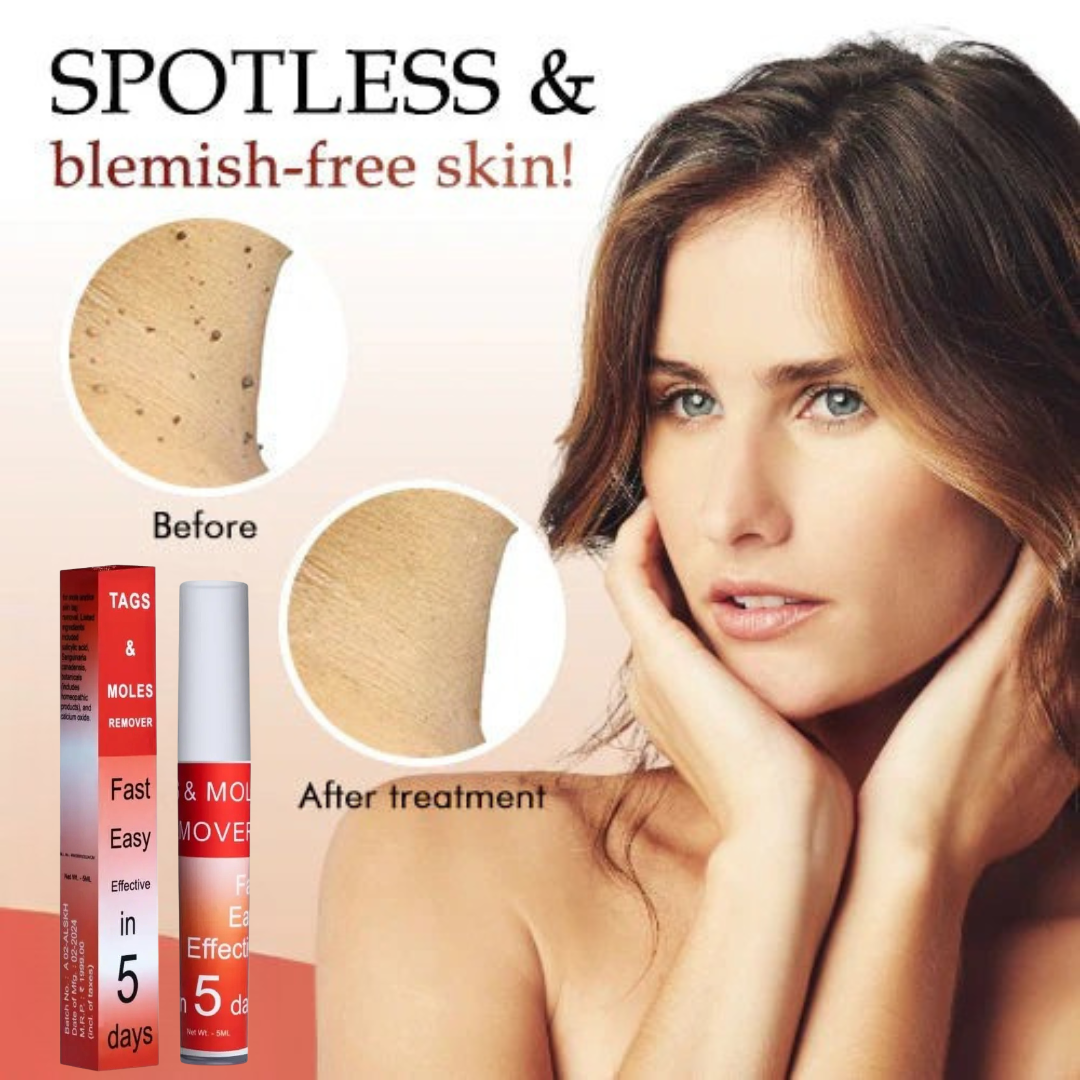 Tags & Moles Remover (Buy 1 Get 1 Free )
