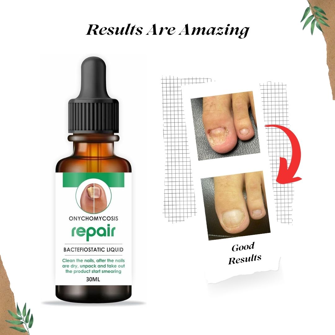 Nail Repair Serum (📢Buy 1 Get 1 FREE)