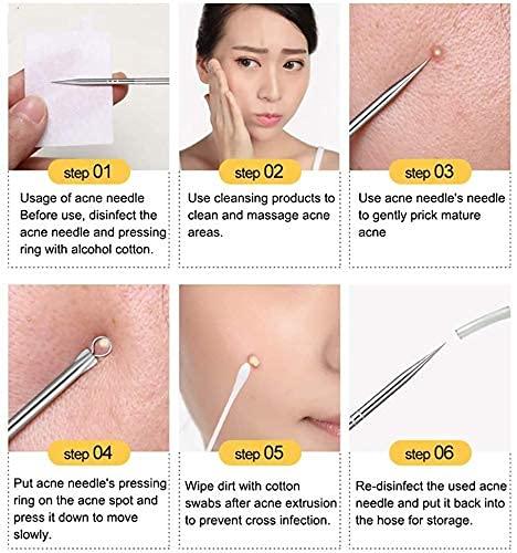 Stainless Steel Blackhead Remover Extractor Tool