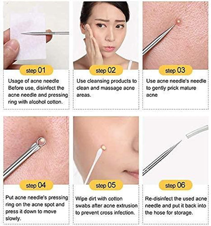 Stainless Steel Blackhead Remover Extractor Tool