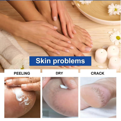 Foot & Fingers Revive Cream (Buy 1 Get 1 Free)