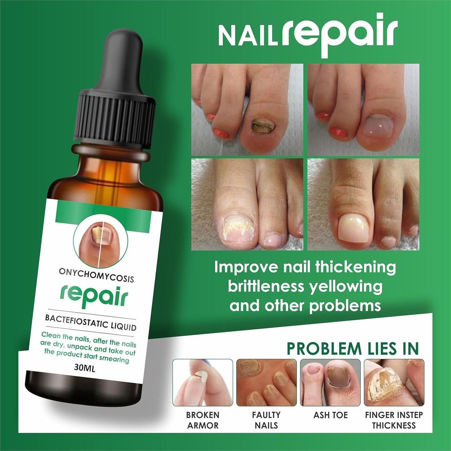 Nail Repair Serum (📢Buy 1 Get 1 FREE)