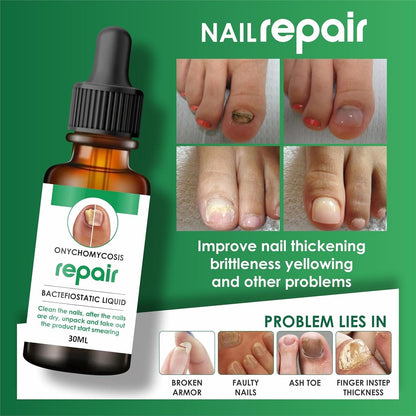 Nail Repair Serum (📢Buy 1 Get 1 FREE)