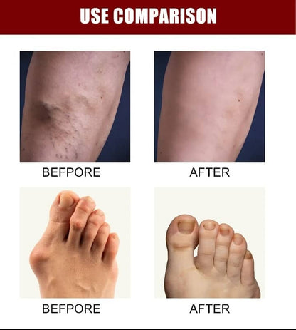 Bone Therapy Cream (Buy 1 Get 1 Free)