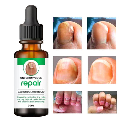Nail Repair Serum (📢Buy 1 Get 1 FREE)